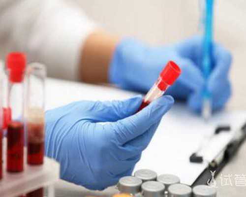 b超测卵泡怎么看单子？监测卵泡的最佳时间b超,供卵试管