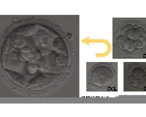 供卵生子中心_合法供卵医院,新乡供卵试管包男孩零风险（北京试管供卵公司）