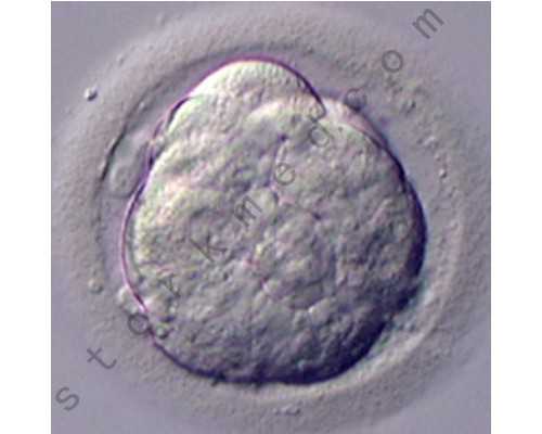 送子鸟供卵价格（北京供卵费用）_杭州哪家医院供卵