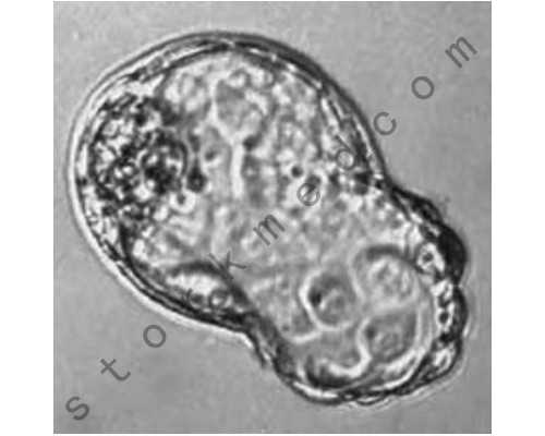 江苏找人带生小孩 江苏试管婴儿费用大约多少？2026试管助孕价格 ‘3次b超是女