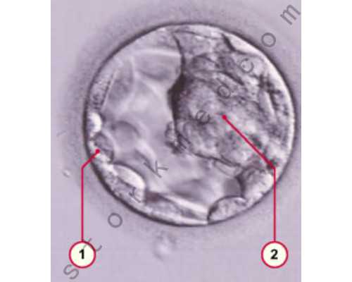 海口三代试管是如何确定性别的，海口试管流程