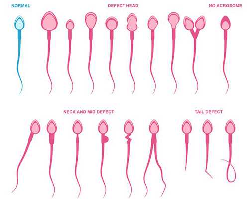 海口供卵试管双胞胎，海口试管婴儿怎么做的全过程