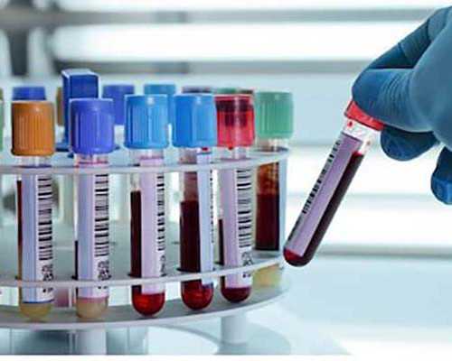 北京供卵中心|供卵试管费用|供卵试管能怀男孩吗?_西安供卵试管婴儿费用