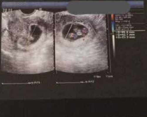 海口代孕公司在哪找|海口三代试管婴儿医院排名？海口哪家试管医院好？