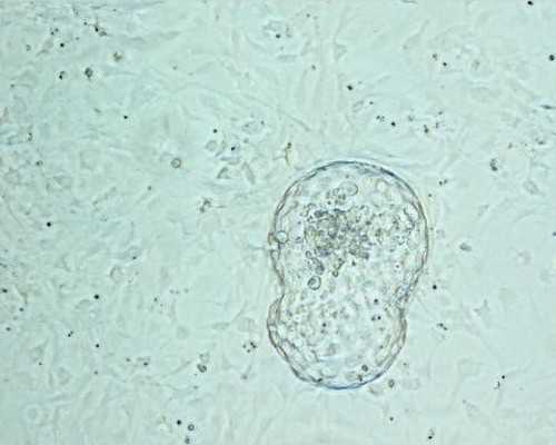 海口借卵助孕服务-浙江助孕微信群