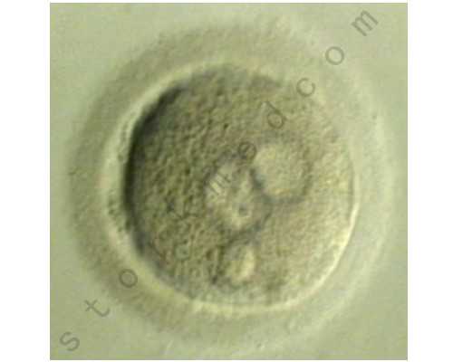 供卵要多少钱_靠谱的供卵中心,北京供卵试管正规的试管医院，内附供精供卵价