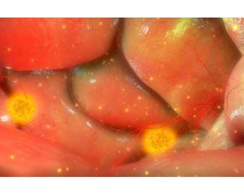 助孕试管供卵_供卵优质_48岁输精管堵塞都可以通过人工授精技术助孕吗?
