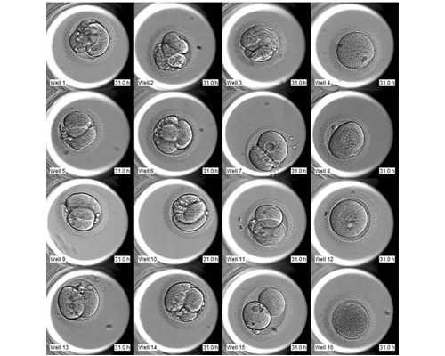 青岛可以借卵生小孩 2026试管助孕详细：青岛妇幼三代试管大概多少钱？ ‘营口