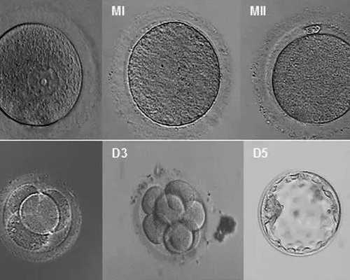 供卵地址_供卵自怀痛苦吗_美国试管婴儿中的六个步骤是什么?