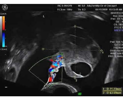海口代生服务公司|海口玛丽医院试管如何(海口玛丽医院试管怎么样)