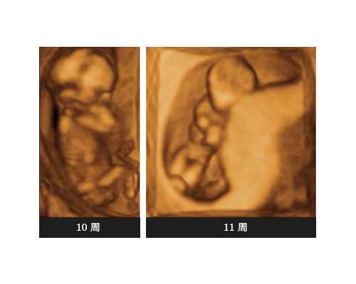 麻秸助孕网供卵_供卵试管中心_清远供卵试管医院：清远试管婴儿取卵注意什么