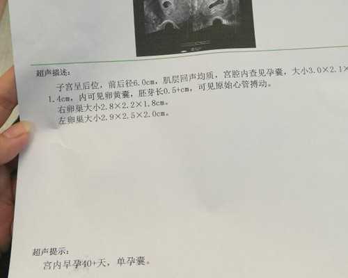 48岁供卵成功率_试管婴儿供卵服务_揭阳女方染色体异常能申请供卵三代试管婴