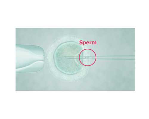 海口三代试管助孕价格