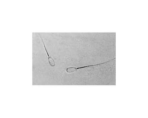 供卵的医院_供卵服务中心,【我想做供卵试管哪个医院有供卵】41周剖宫产女宝