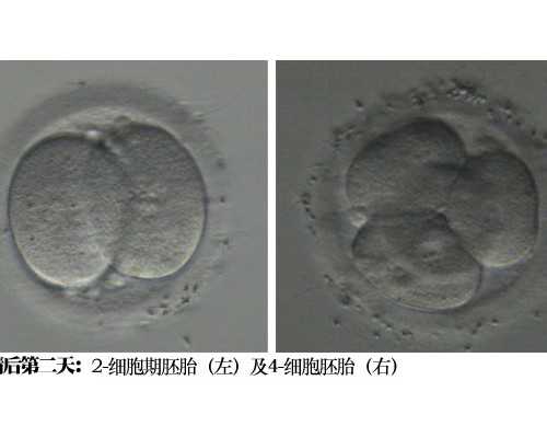 白带拉丝同房会怀孕吗