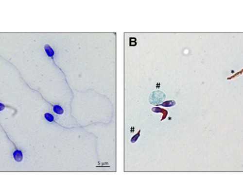 海口供卵靠谱机构|海口三代试管婴儿医院排名?海口哪家试管医院好?