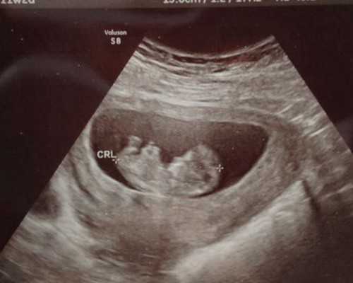 供卵咨询中心在哪_供卵生子会后悔吗_江西供卵二代试管婴儿生男孩包成功费用