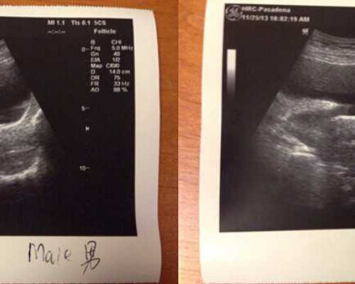 海口做代怀的医院|海口供卵试管男孩，海口试管婴儿怎么做的全过程