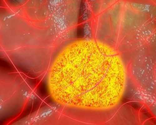 海口试管婴儿三代的利弊海口试管婴儿费用大约多少