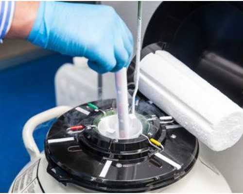 晋中供卵试管,试管婴儿供卵