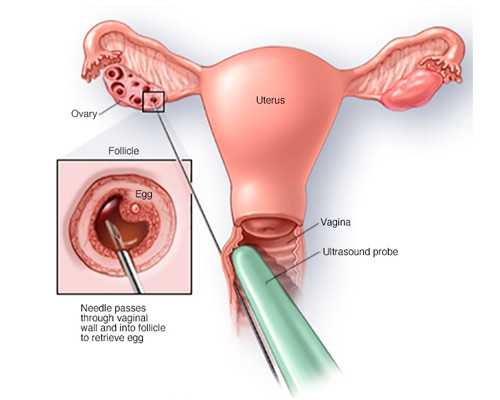 想求供卵生孩子_供卵试管经历,武威供卵试管婴儿个人空间,试管婴儿供卵