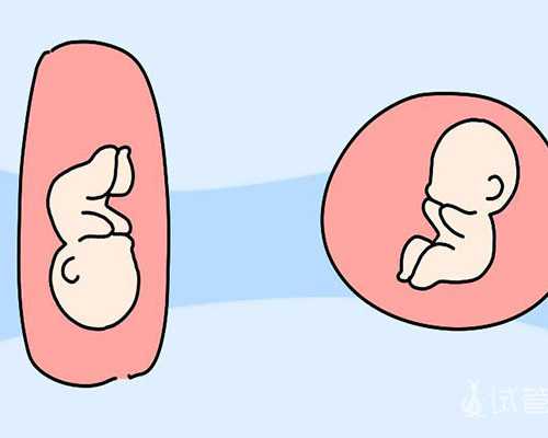 海口怎样捐卵的