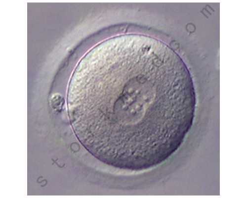 穿刺卵泡的价格,代生孩子医院