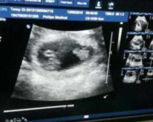 地下供卵_供卵盲选_宜春供卵试管机构：江西宜春哪里可以做三代试管婴儿？