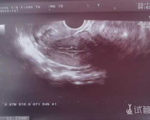 哪里有供卵医院_供卵经历_台北供卵费用,台北荣民总医院供卵试管费用