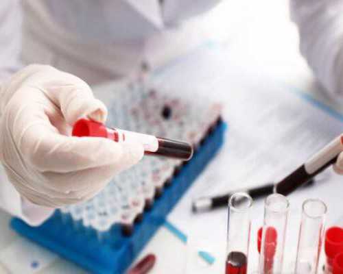 海口捐卵子费用