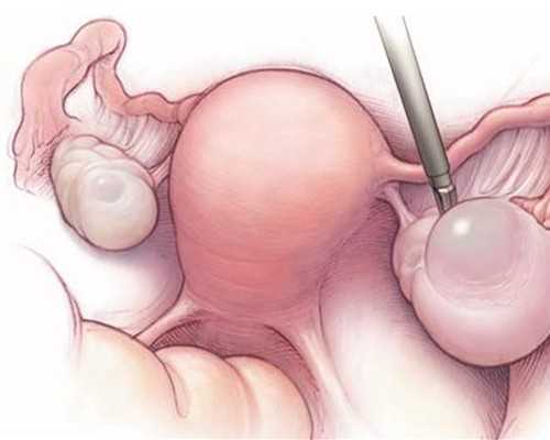 供卵第三代试管_美国供卵论坛_广州做试管包男孩多少钱?需要花很多钱吗?