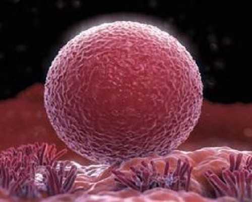 婴儿鱼鳞病图片及其治疗方法