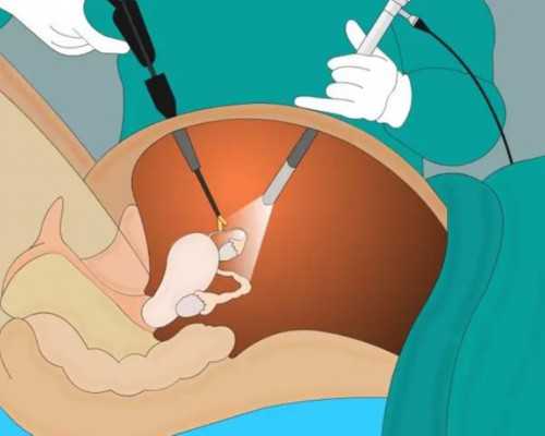 高龄试管一定要做三代?第三代试管婴儿最突出的优势,供卵自怀