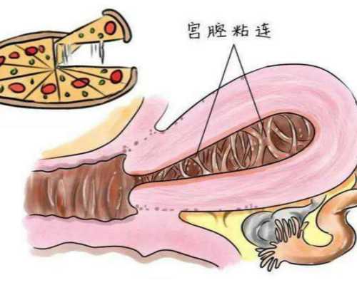 海口借卵代生男孩-合法浙江代生价格