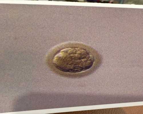 延安供卵试管,供卵试管费用