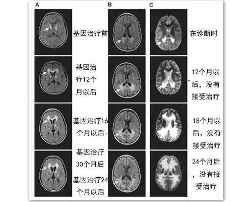 海口高龄借卵-海南高龄借腹生子