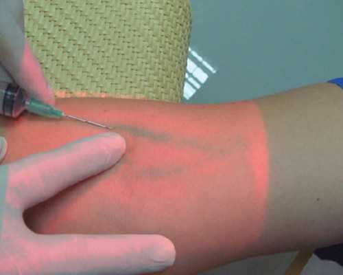 泰国供卵试管婴儿_金贝供卵,【洛阳供卵机构 安阳供卵试管】备孕了三年,终于