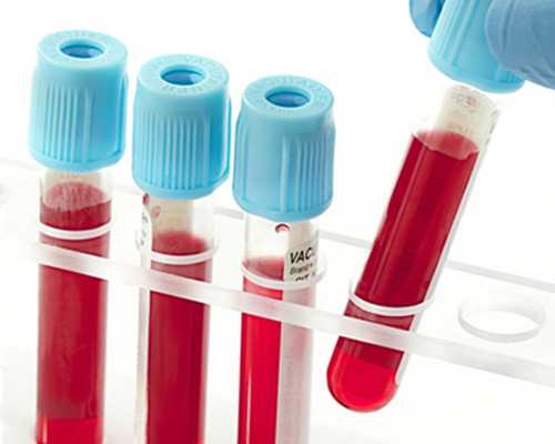 孕妇饮食指南:牛排的优质选择与蛋白质摄入建议探讨