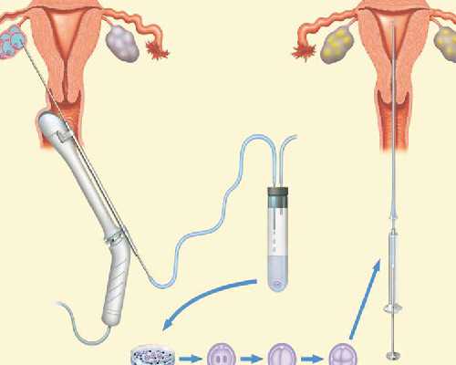 药物甲亢影响备孕吗