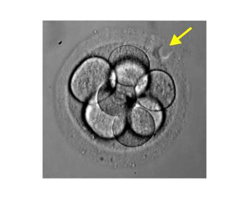 海口供卵代生技术-海口哪个供卵医院