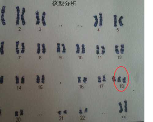 供卵经历_供精供卵试管婴儿_浙江拟规定:将试管婴儿费用纳入医保,提高0至