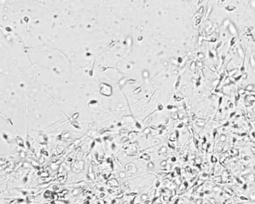 厦门助孕有多少钱 厦门市妇幼做试管婴儿好不好?厦门妇幼试管怎么样? ‘三个