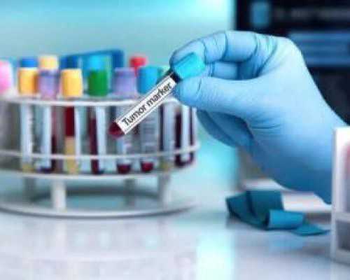 「卵泡」卵泡多是什么原因造成的,正规供卵医院